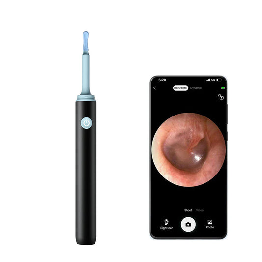 AurisPro™ - Visual Smart Ear Cleaner