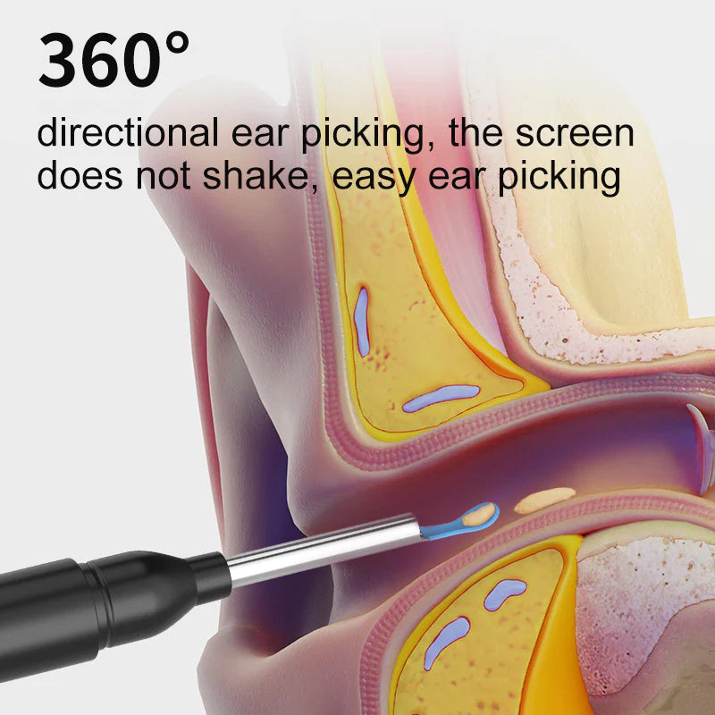 AurisPro™ - Visual Smart Ear Cleaner