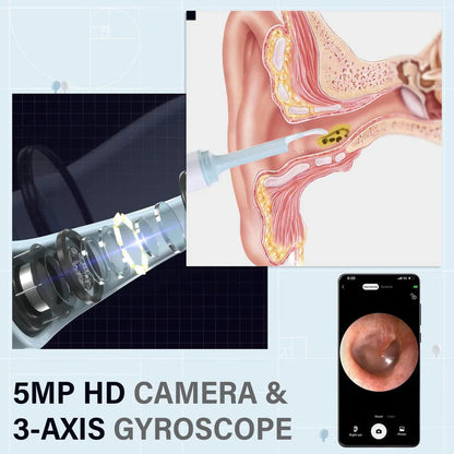 AurisPro™ - Visual Smart Ear Cleaner