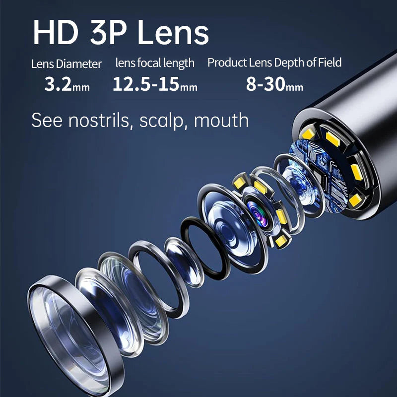 AurisPro™ - Visual Smart Ear Cleaner