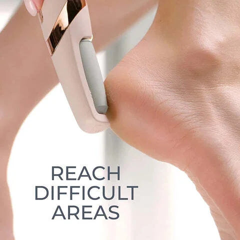 Rechargeable Callus & Dead Skin Remover